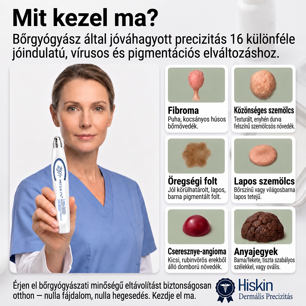 Hivatalos Márkabolt | 🚢 Hiskin® 7 napos Szemölcseltávolító Roll-on Ápoló Folyadék (Fájdalommentes rollerball technológia, hegek nélkül)