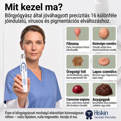 Hivatalos Márkabolt | 🚢 Hiskin® 7 napos Szemölcseltávolító Roll-on Ápoló Folyadék (Fájdalommentes rollerball technológia, hegek nélkül)