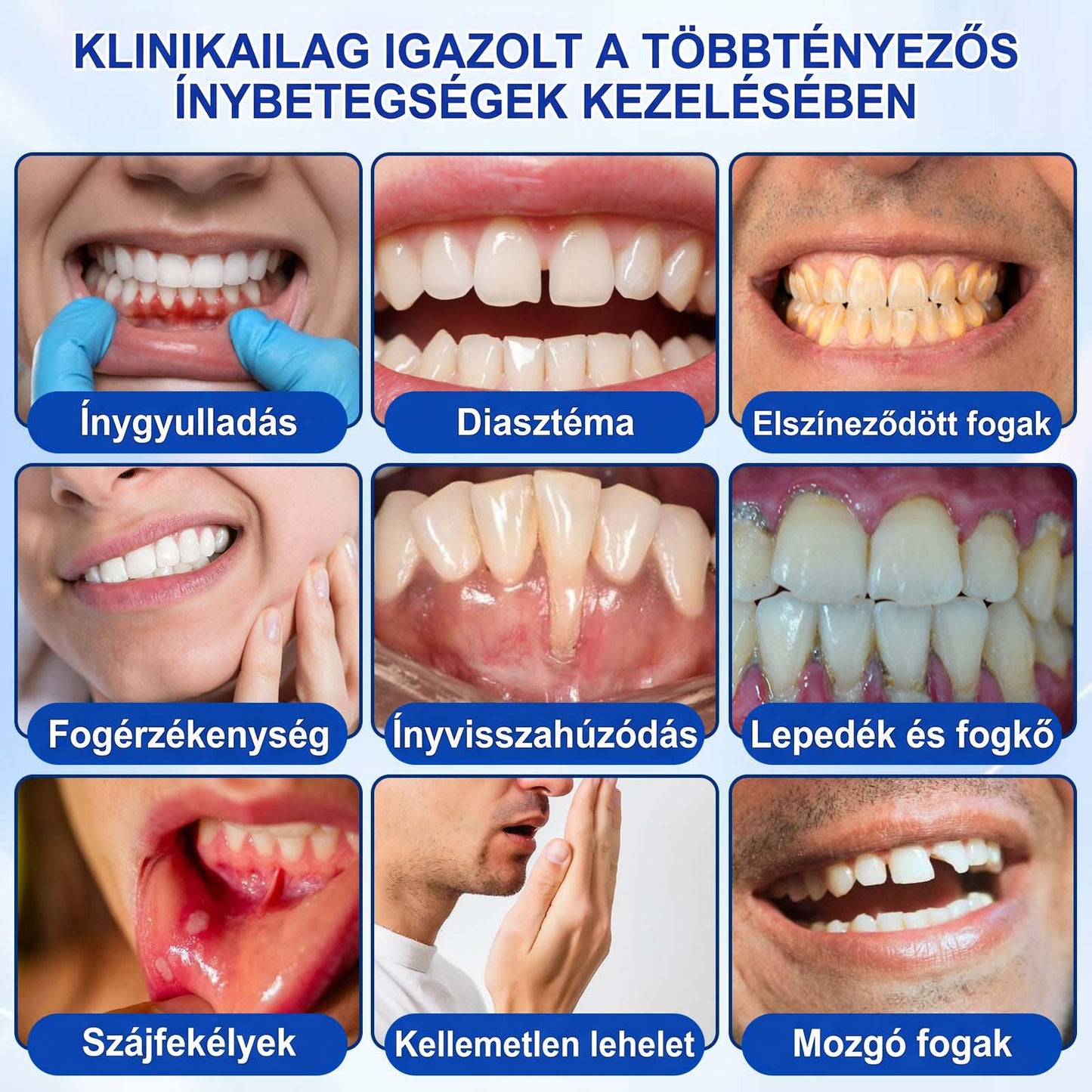 PureShade® 🦷 GumRevive Ínyregeneráló Gél – Az egészségesebb ínyért és magabiztosabb mosolyért 👍