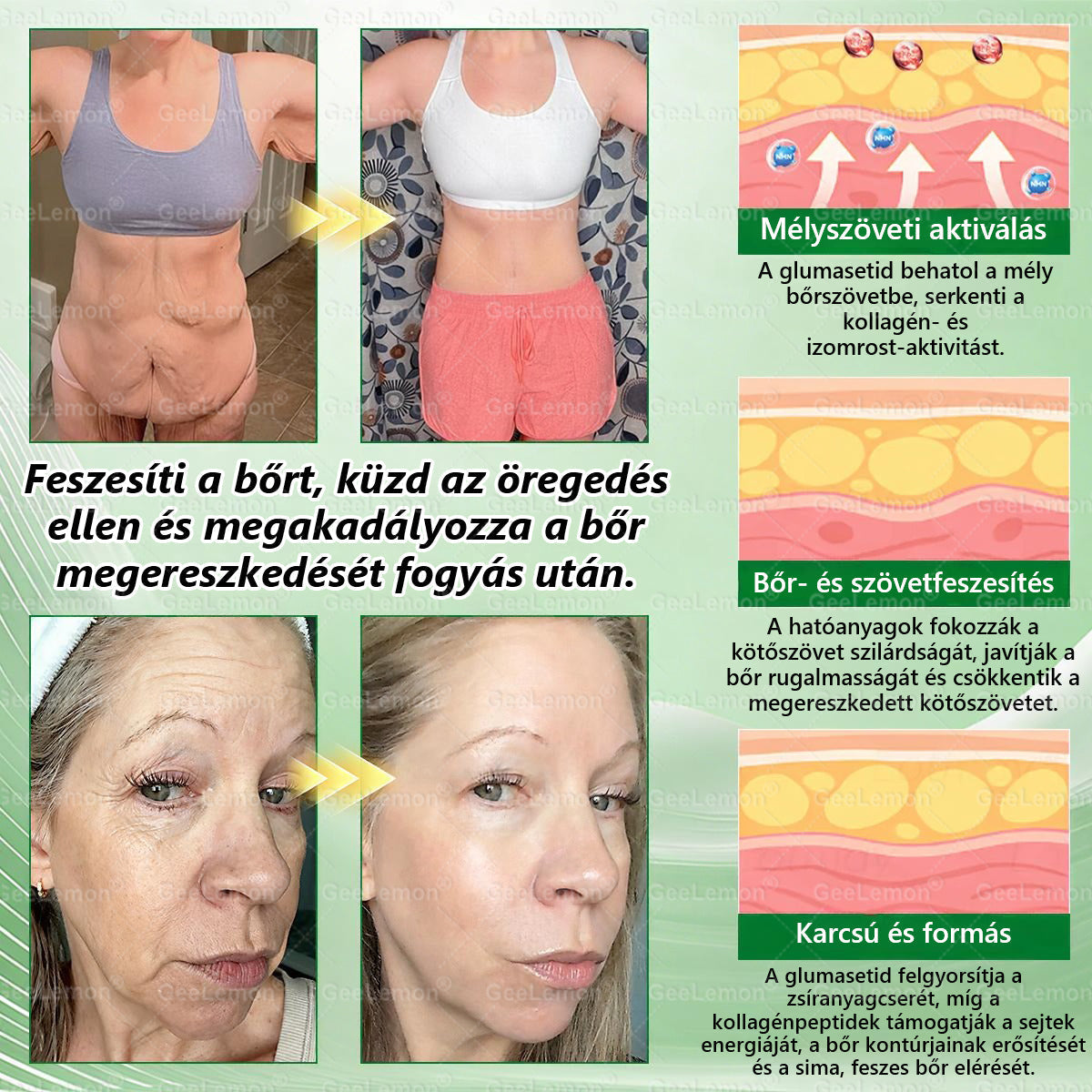 👉 Hivatalos tanúsítás🔥 Több ezer elégedett felhasználó Magyarországon| 🤍𝐆𝐞𝑒𝐿𝑒𝐦𝐨𝐧® Glumasetide 10 az 1-ben Karcsú és Egészséges Nano Mikrotűs Tapasz 🇭🇺