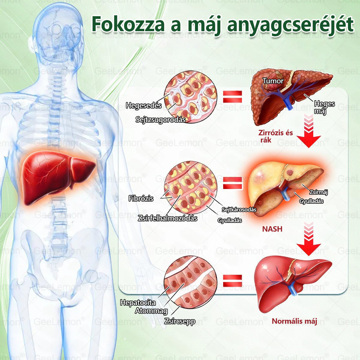 👉 Hivatalos tanúsítás🔥 Több ezer elégedett felhasználó Magyarországon| 🤍𝐆𝐞𝑒𝐿𝑒𝐦𝐨𝐧® Glumasetide 10 az 1-ben Karcsú és Egészséges Nano Mikrotűs Tapasz 🇭🇺