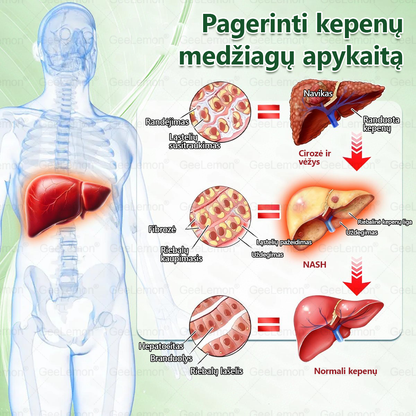 🎁Rekomenduojama Santaros klinikų · 👩‍⚕️ Oficiali „Eurovaistinė“ vaistinė🎁 𝐆𝐞𝑒𝐿𝑒𝐦𝐨𝐧® 𝐆𝐥𝐮𝐦𝐚𝐬𝐞𝐭𝐢𝐝𝐞 8 viename Liekninantis ir sveikatinantis nano pleistras su mikroadatomis 🇱🇹 (Tik kartą per dieną, matomi pokyčiai jau per 7 dienas)  ✅