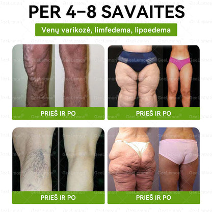 🎁Rekomenduojama Santaros klinikų · 👩‍⚕️ Oficiali „Eurovaistinė“ vaistinė🎁 𝐆𝐞𝑒𝐿𝑒𝐦𝐨𝐧® 𝐆𝐥𝐮𝐦𝐚𝐬𝐞𝐭𝐢𝐝𝐞 8 viename Liekninantis ir sveikatinantis nano pleistras su mikroadatomis 🇱🇹 (Tik kartą per dieną, matomi pokyčiai jau per 7 dienas)  ✅