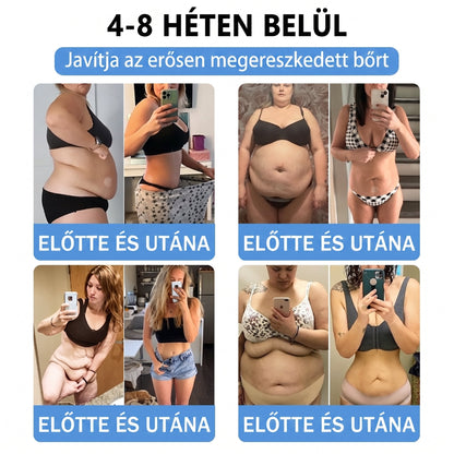 🎁Hivatalos tanúsítás🔥 Több ezer elégedett felhasználó Magyarországon| 🤍FFBSI® Glumasetide 10 az 1-ben Karcsú és Egészséges Nano Mikrotűs Tapasz 🇭🇺