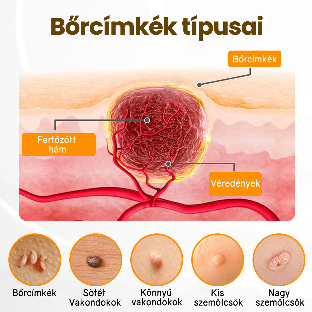 Fájdalommentesen és hatékonyan távolítja el a különböző szemölcsökety👨‍⚕️ APKAPK® Méhméreg Bőrmegújító Krém segít eltávolítani a közönséges, talpi, lapos és fonalas szemölcsöket, valamint a papillómákat