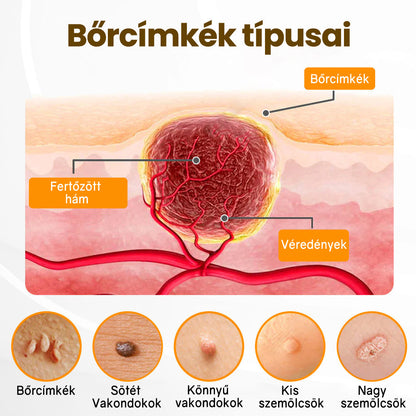 Fájdalommentesen és hatékonyan távolítja el a különböző szemölcsökety👨‍⚕️ APKAPK® Méhméreg Bőrmegújító Krém segít eltávolítani a közönséges, talpi, lapos és fonalas szemölcsöket, valamint a papillómákat