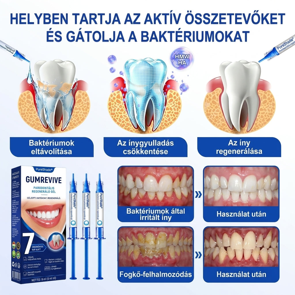 PureShade® 🦷 GumRevive Ínyregeneráló Gél – Az egészségesebb ínyért és magabiztosabb mosolyért 👍