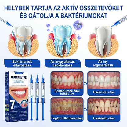 PureShade® 🦷 GumRevive Ínyregeneráló Gél – Az egészségesebb ínyért és magabiztosabb mosolyért 👍