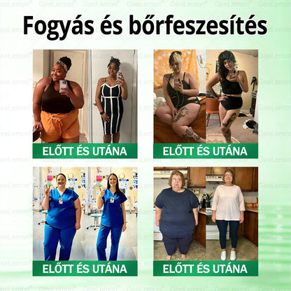 👉 Hivatalos tanúsítás🔥 Több ezer elégedett felhasználó Magyarországon| 🤍𝐆𝐞𝑒𝐿𝑒𝐦𝐨𝐧® Glumasetide 10 az 1-ben Karcsú és Egészséges Nano Mikrotűs Tapasz 🇭🇺