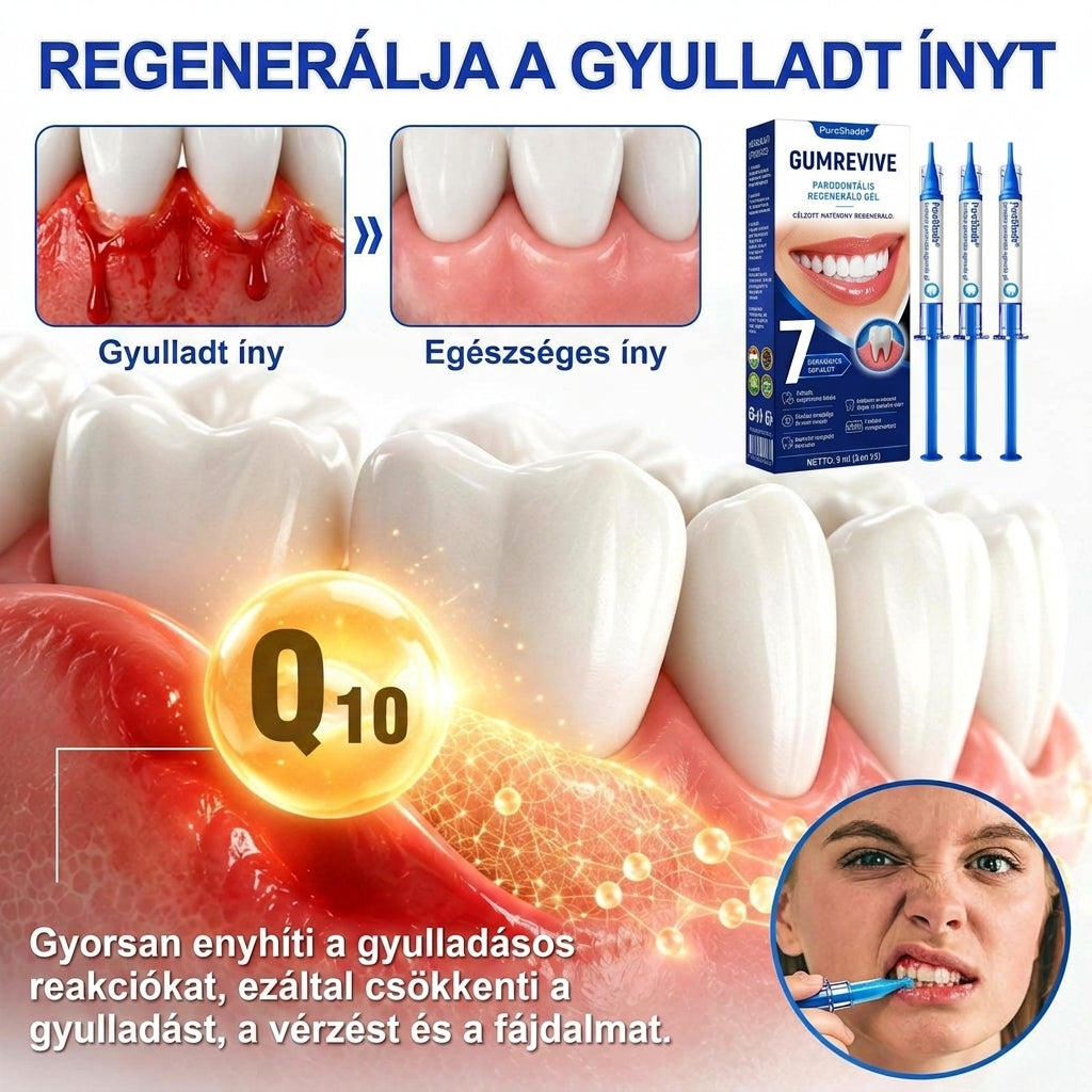 PureShade® 🦷 GumRevive Ínyregeneráló Gél – Az egészségesebb ínyért és magabiztosabb mosolyért 👍