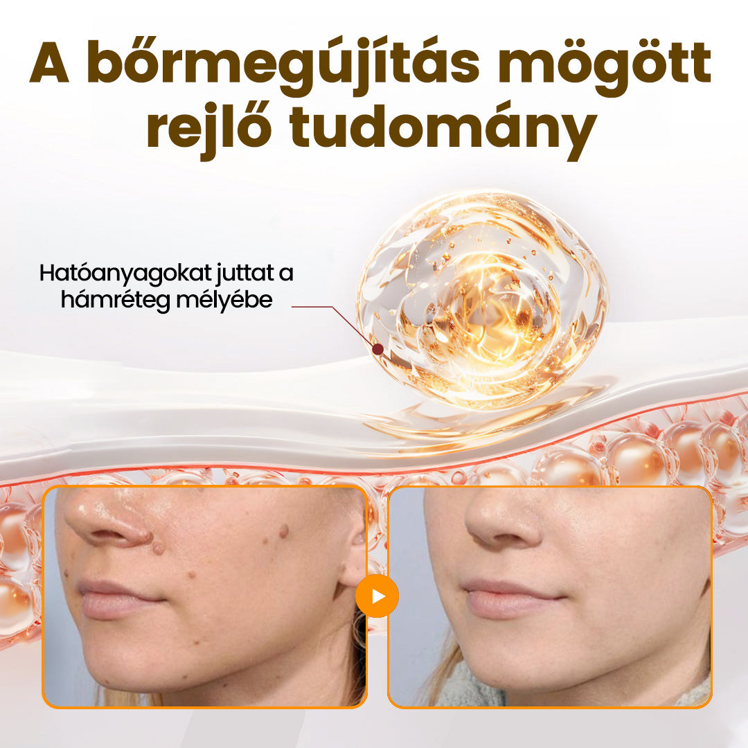 Fájdalommentesen és hatékonyan távolítja el a különböző szemölcsökety👨‍⚕️ APKAPK® Méhméreg Bőrmegújító Krém segít eltávolítani a közönséges, talpi, lapos és fonalas szemölcsöket, valamint a papillómákat