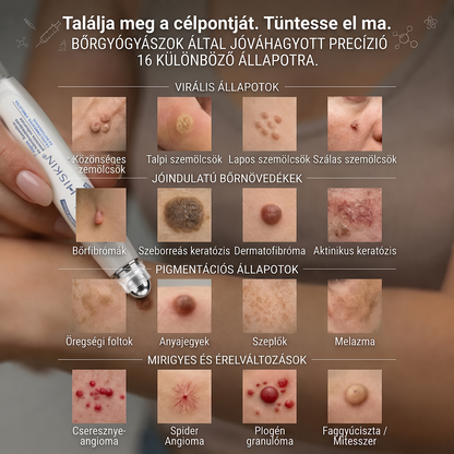 Hivatalos Márkabolt | 🚢 Hiskin® 7 napos Szemölcseltávolító Roll-on Ápoló Folyadék (Fájdalommentes rollerball technológia, hegek nélkül)