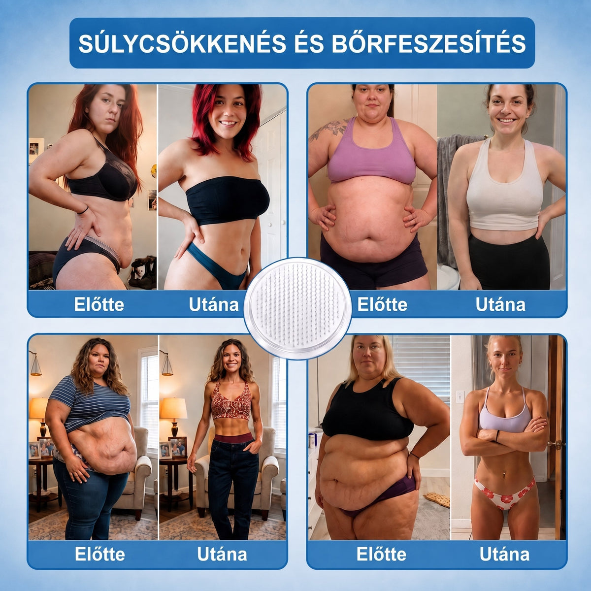 🎁Hivatalos tanúsítás🔥 Több ezer elégedett felhasználó Magyarországon| 🤍FFBSI® Glumasetide 10 az 1-ben Karcsú és Egészséges Nano Mikrotűs Tapasz 🇭🇺