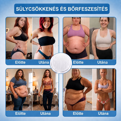 🎁Hivatalos tanúsítás🔥 Több ezer elégedett felhasználó Magyarországon| 🤍FFBSI® Glumasetide 10 az 1-ben Karcsú és Egészséges Nano Mikrotűs Tapasz 🇭🇺