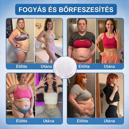 🎁Hivatalos tanúsítás🔥 Több ezer elégedett felhasználó Magyarországon| 🤍FFBSI® Glumasetide 10 az 1-ben Karcsú és Egészséges Nano Mikrotűs Tapasz 🇭🇺