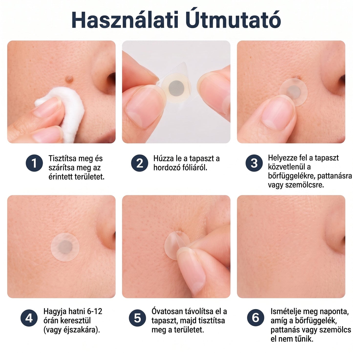 ✨✨✨PURESHADE® 2 az 1-ben mikrotűs és hidrokolloid tapasz🍀 | Kiálló anyajegyek, aknék, lapos szemölcsök és bőrnövedékek eltávolítására | Segít csökkenteni a ráncokat, hegeket és bőrhibákat | Láthatatlan tapasz az arcra és testre