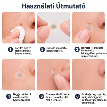 ✨✨✨PURESHADE® 2 az 1-ben mikrotűs és hidrokolloid tapasz🍀 | Kiálló anyajegyek, aknék, lapos szemölcsök és bőrnövedékek eltávolítására | Segít csökkenteni a ráncokat, hegeket és bőrhibákat | Láthatatlan tapasz az arcra és testre
