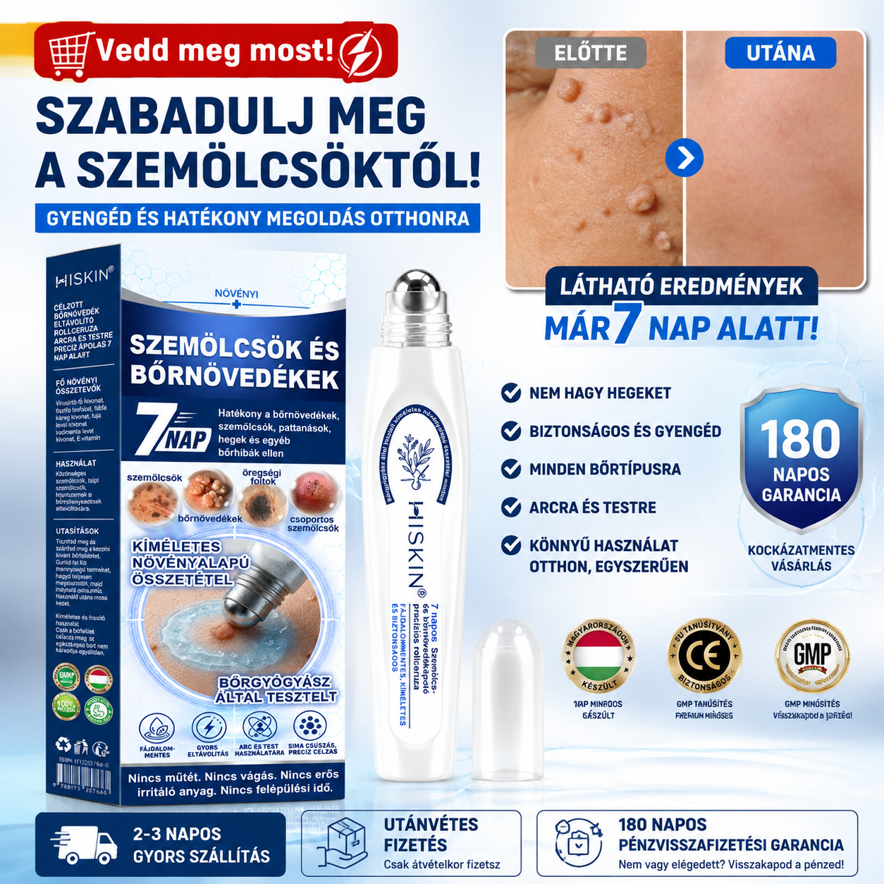 💞Hivatalos Márkabolt | 🚢 Hiskin® 7 napos Szemölcseltávolító Roll-on Ápoló Folyadék (Fájdalommentes rollerball technológia, hegek nélkül)