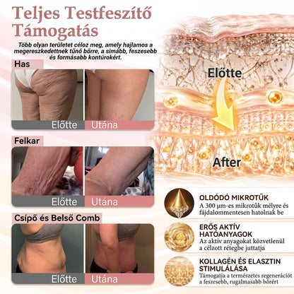 🥇HISKIN® MELLEMELŐ ÉS FESZESÍTŐ MIKROTŰS TAPASZOK