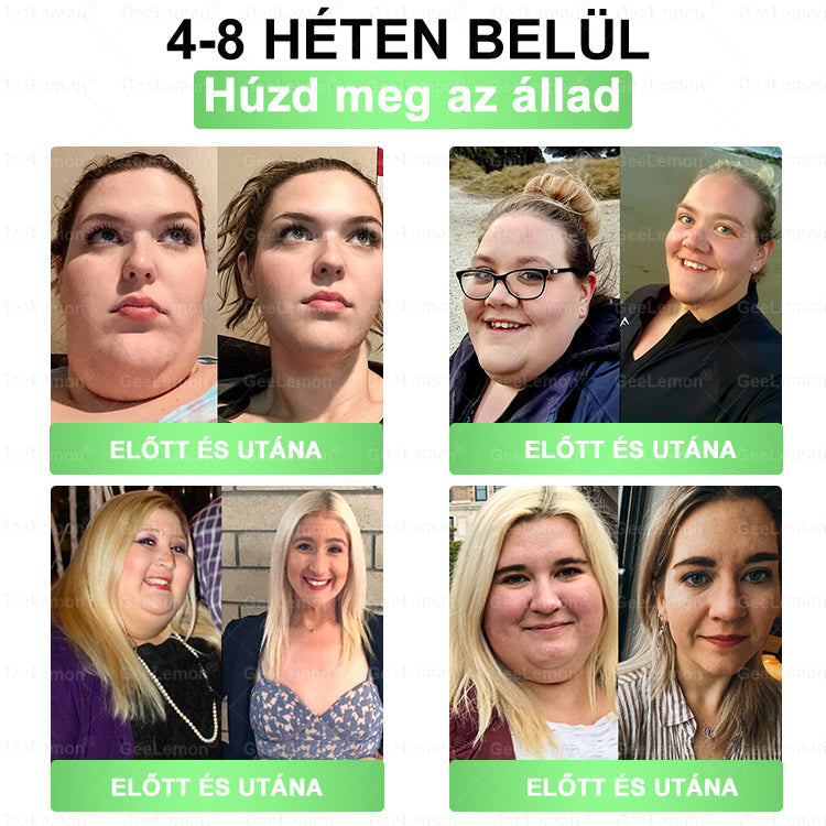 👉 Hivatalos tanúsítás🔥 Több ezer elégedett felhasználó Magyarországon| 🤍𝐆𝐞𝑒𝐿𝑒𝐦𝐨𝐧® Glumasetide 10 az 1-ben Karcsú és Egészséges Nano Mikrotűs Tapasz 🇭🇺