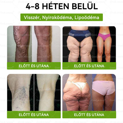 👉 Hivatalos tanúsítás🔥 Több ezer elégedett felhasználó Magyarországon| 🤍𝐆𝐞𝑒𝐿𝑒𝐦𝐨𝐧® Glumasetide 10 az 1-ben Karcsú és Egészséges Nano Mikrotűs Tapasz 🇭🇺