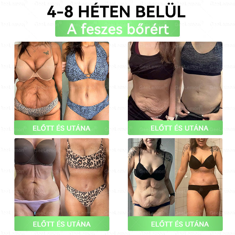 👉 Hivatalos tanúsítás🔥 Több ezer elégedett felhasználó Magyarországon| 🤍𝐆𝐞𝑒𝐿𝑒𝐦𝐨𝐧® Glumasetide 10 az 1-ben Karcsú és Egészséges Nano Mikrotűs Tapasz 🇭🇺